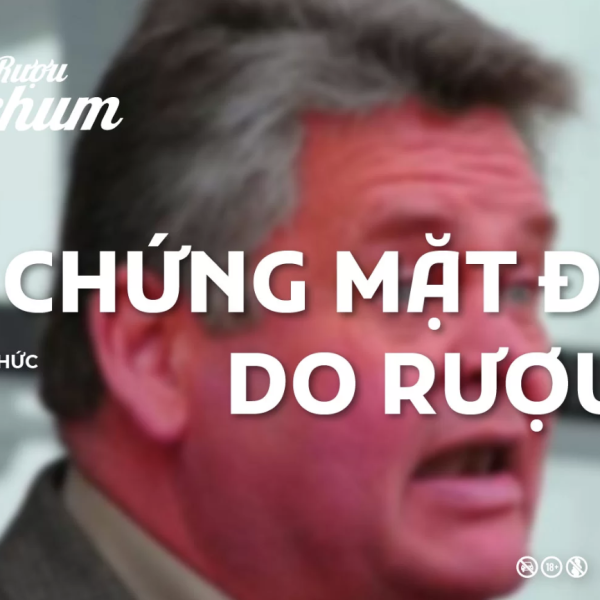 hoi-chung-mat-do-do-ruou-bia